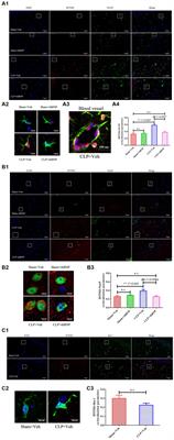 Interferon-induced transmembrane protein 3 in the hippocampus: a potential novel target for the therapeutic effects of recombinant human brain natriuretic peptide on sepsis-associated encephalopathy